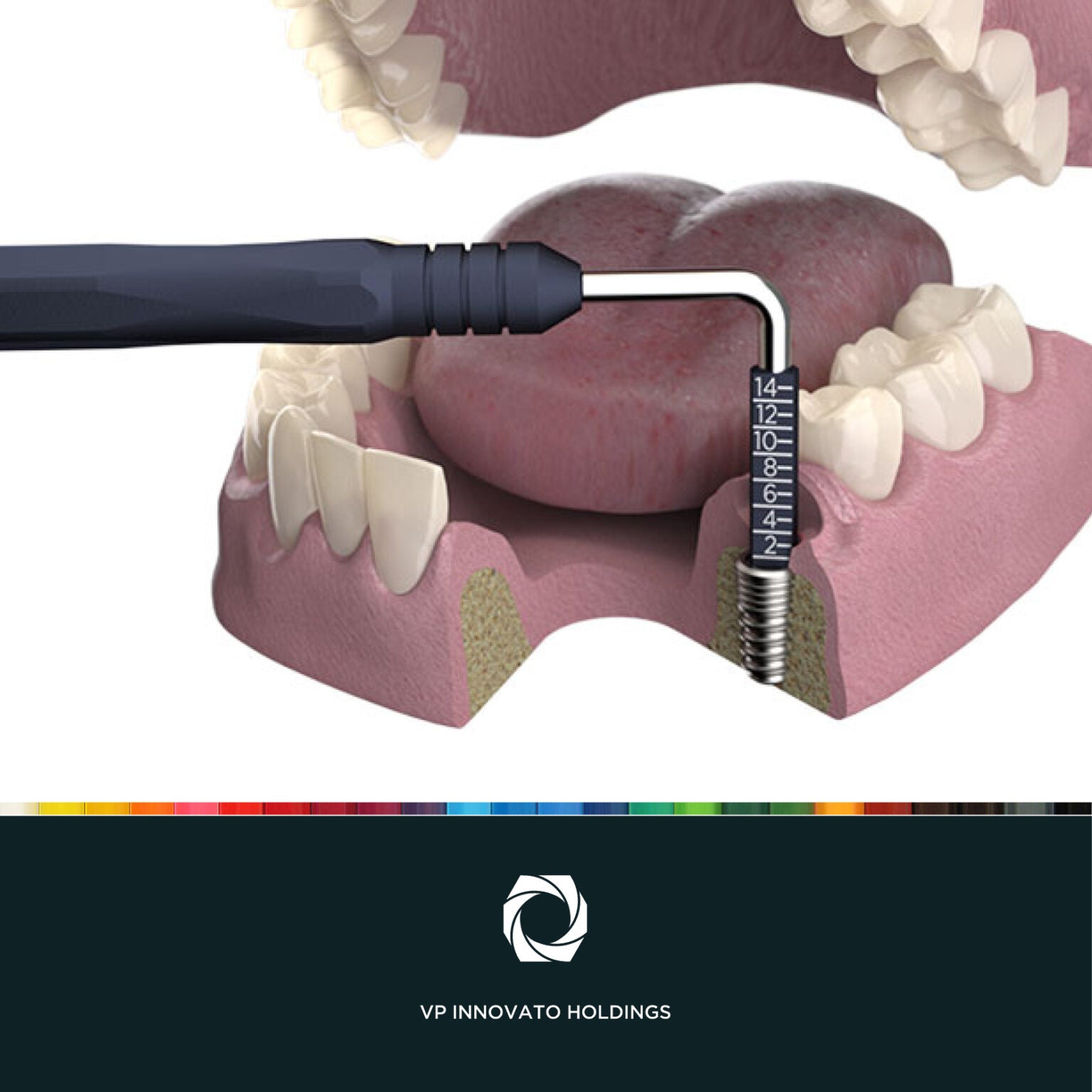 Cervico™ Guide, 5213006650017