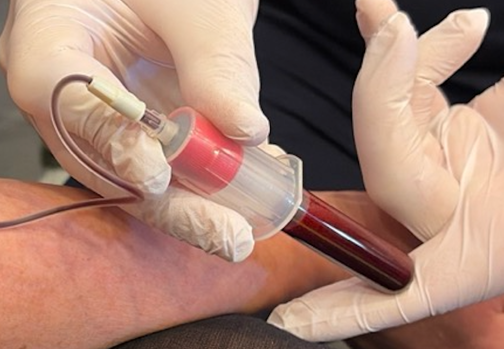 Glasrør til PRF membraner, 10 ml, 100 stk i kasse
