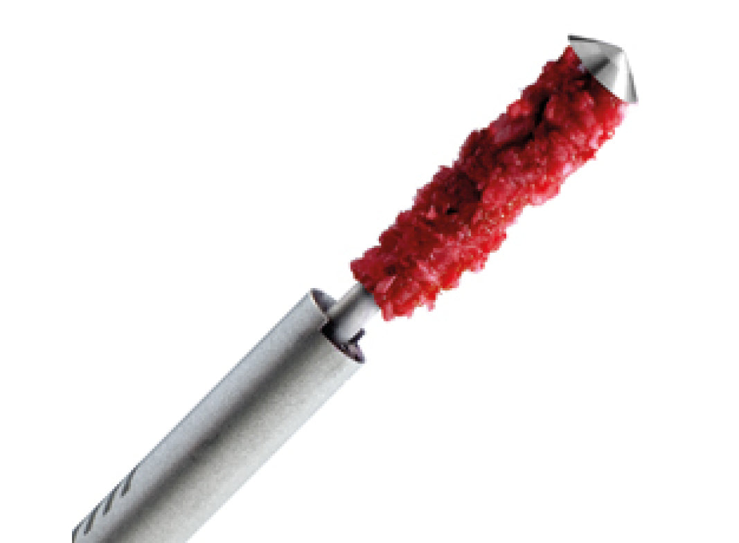 Micross Tunnel harvesting technique bone scraper