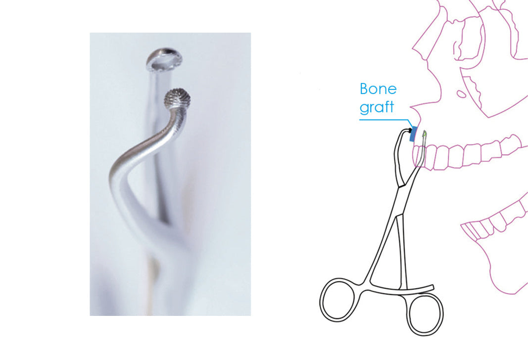 MJK Bone block holder