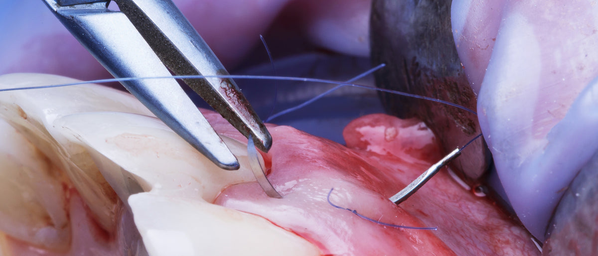 Socket grafting workshop