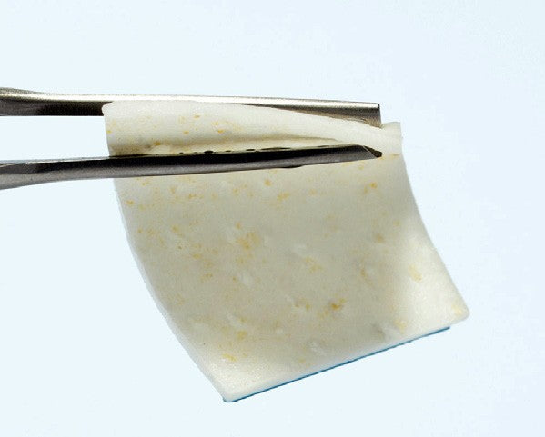 NOVAMag magnesiummembran håndteret med pincet