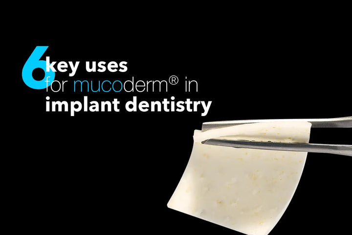 Coverbillede til webinaret 6 key uses for mucoderm® in implant dentistry: a clinical webinar
