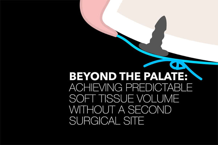 Coverbillede til webinaret Beyond the Palate: Achieving Predictable Soft Tissue Volume Without a Second Surgical Site