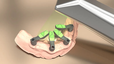 Implantatscanning
