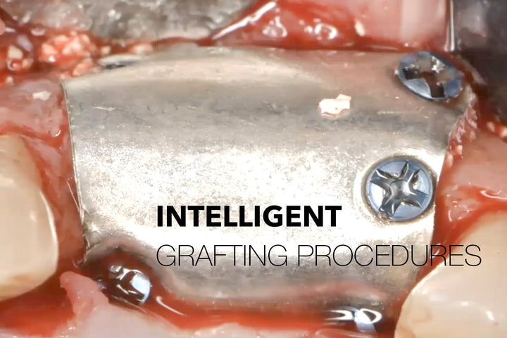 Coverbillede til webinaret Predictable and safer GBR: Biodegradable Magnesium Membrane (NOVAMag®)