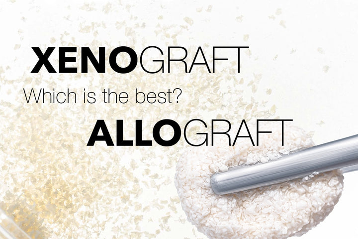 Coverbillede til webinaret Xenograft or Allograft – which is the best?