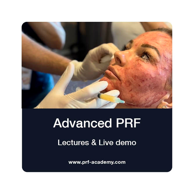 PA02: PRF in Facial Aesthetics, Advanced
