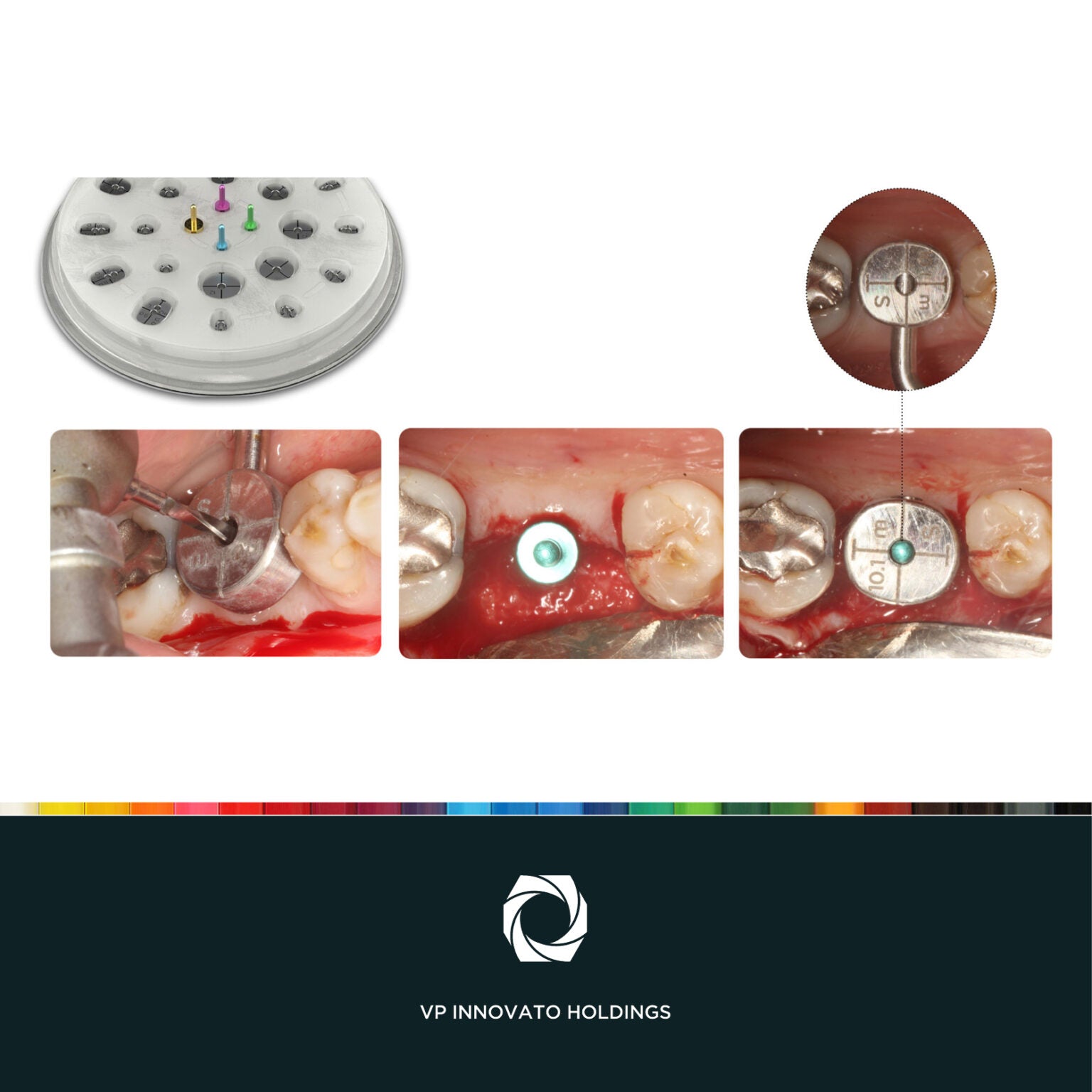 Cervico™ Guide, 5213006650017