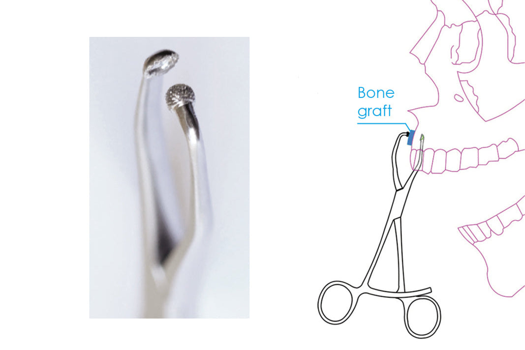 MJK Bone block holder