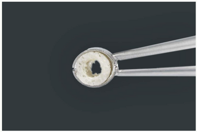 maxgraft®  bone ring surgical kit - 33000