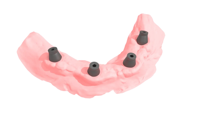 Vævsscanning