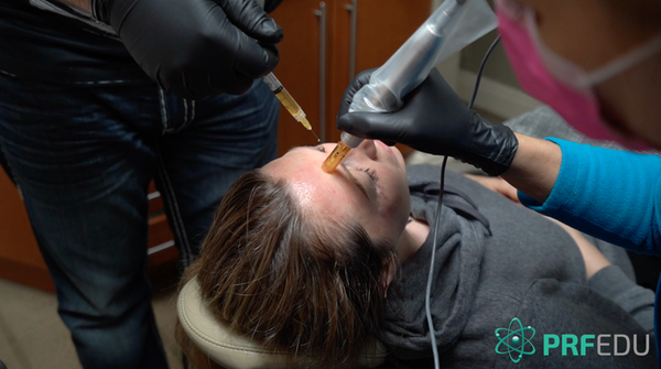 PRF in Facial Esthetics and Sports Medicine online course