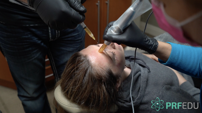 PRF in Facial Esthetics and Sports Medicine online course