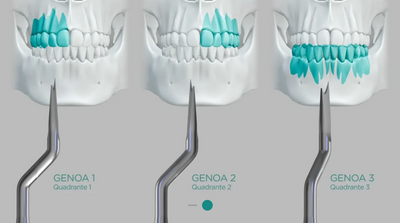Genoa Bone Split-instrumenter