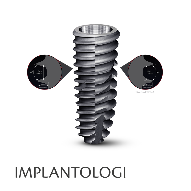 Implantologi